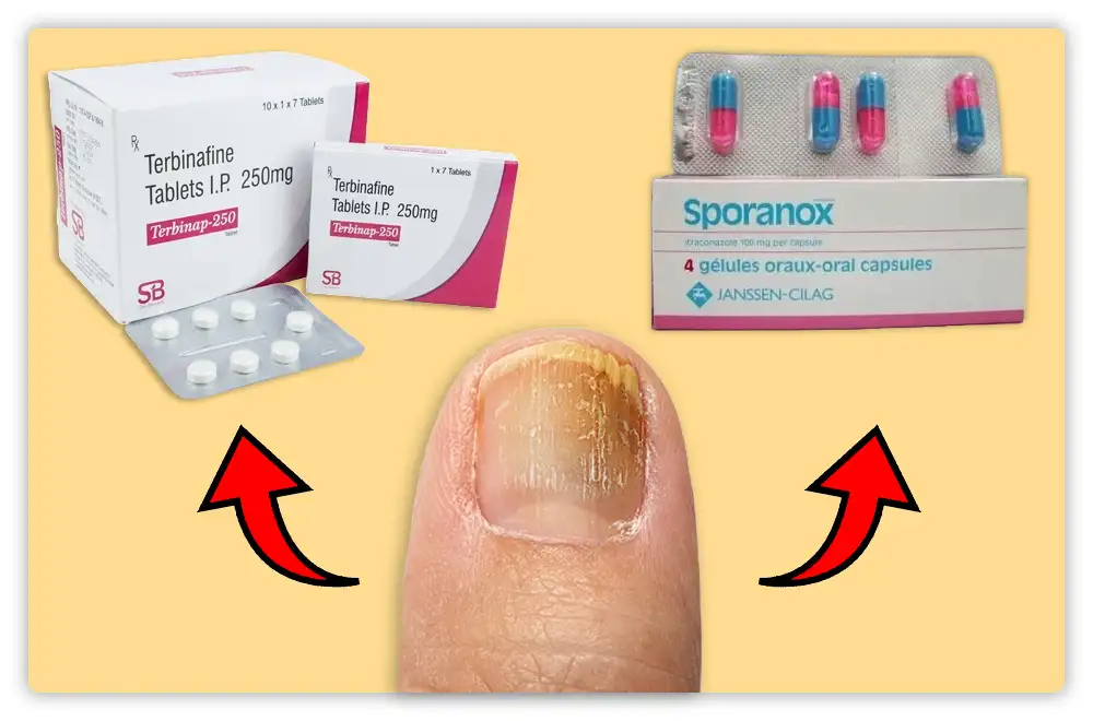 Antifungal Medications for Toenail Fungus Antifungal Medications for Toenail Fungus