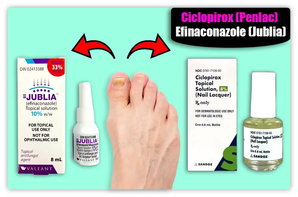 Topical Antifungal Treatments for Toenail Fungus Topical Antifungal Treatments for Toenail Fungus